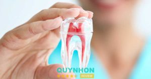 danh sách 5 cơ sở nha khoa điều trị tủy răng ở Quy Nhơn