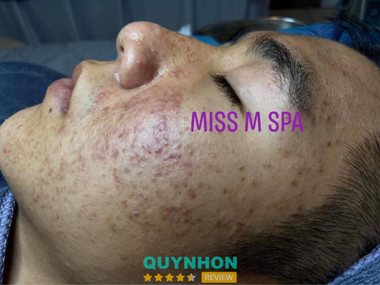 Miss M Spa, TP. Pleiku