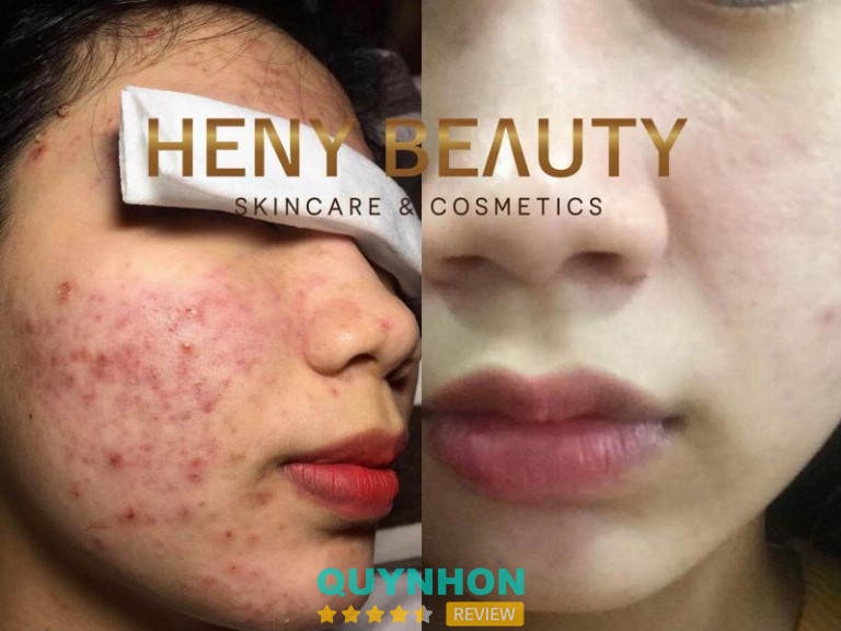 Heny Beauty, TP. Pleiku