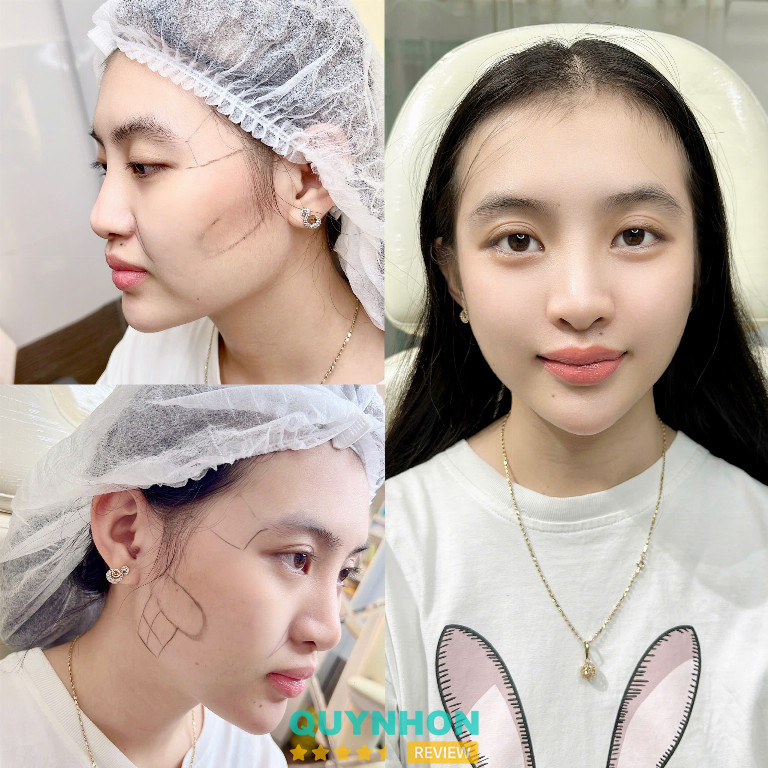 Hải Yến Beauty & Spa Quy Nhơn