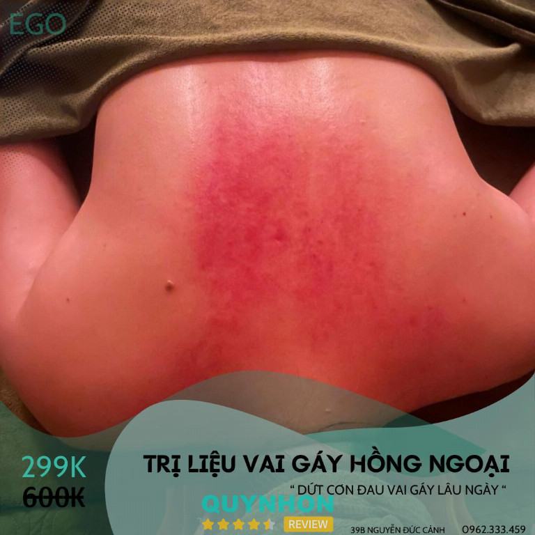Dịch vụ massage ở Gia Lai 