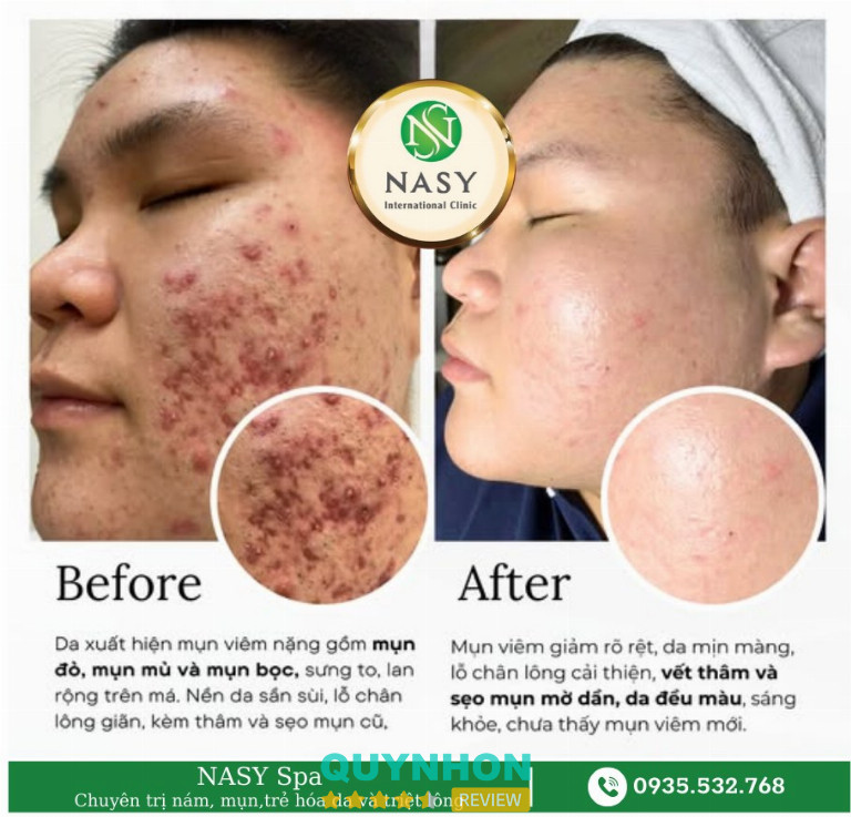 Thủy Tiên Spa - P. Diên Hồng