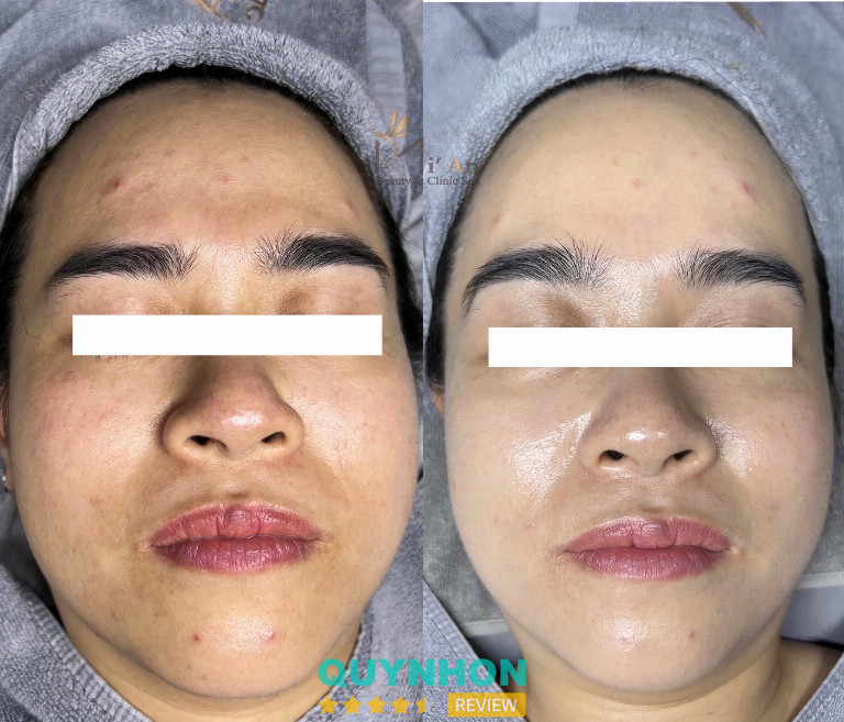 Mi'An Beauty & Clinic Spa - Pleiku