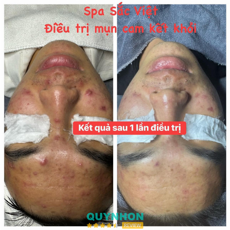 Spa Sắc Việt - Pleiku