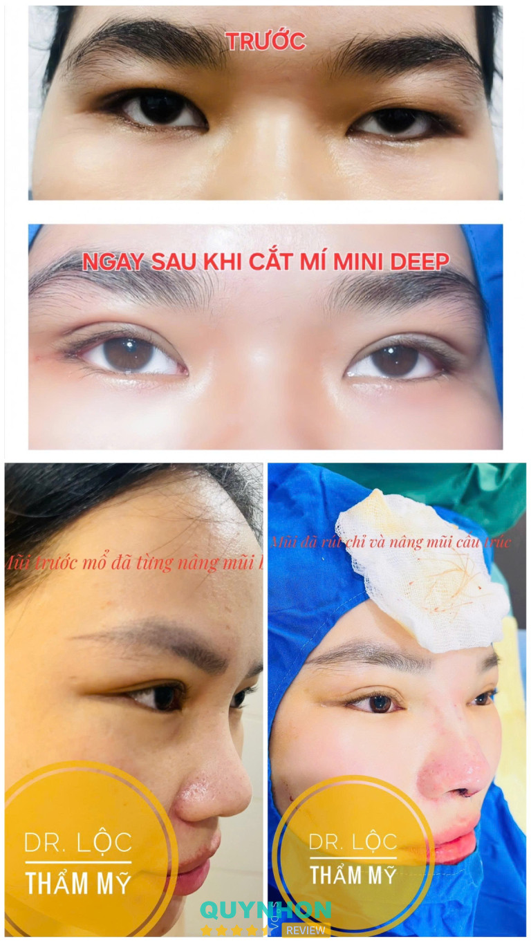 Phòng Khám Mắt - Thẩm Mỹ BS Lộc tại Quy Nhơn