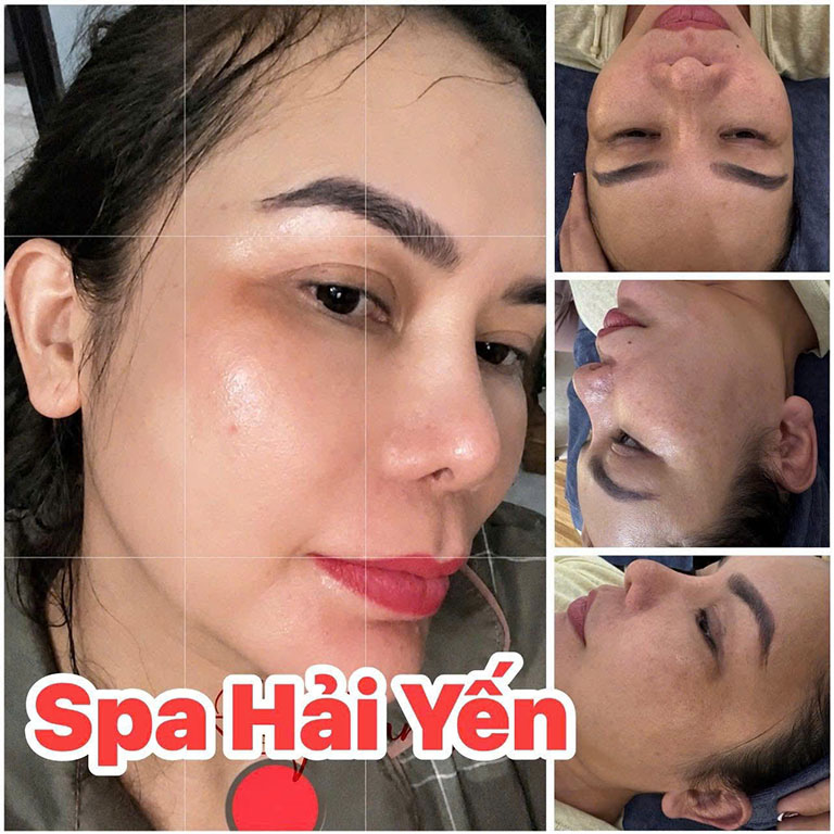 Hải Yến Spa Beauty – hình ảnh hoạt động 3