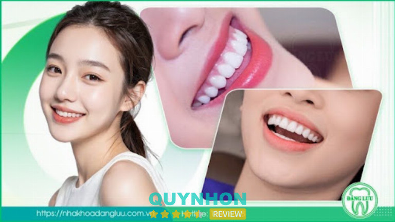 Nha Khoa Đăng Lưu chú trọng quy trình bọc sứ, bảo vệ răng thật và khớp cắn