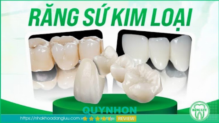 Nha Khoa Đăng Lưu xác định chi phí bọc sứ theo vật liệu và tình trạng răng